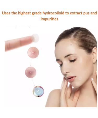 Pimple Patches 180 Count with Tweezers - Hydrocolloid Acne Cover Patch for Quick Healing - Spot Stickers for Face and Skin - Buy Online on GoSupps.com