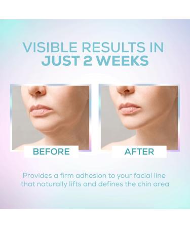 VENUS VISAGE V-Line Chin Mask - Double Chin Reduction Jawline Definition 5-Pack for Men & Women - Buy Online on GoSupps.com
