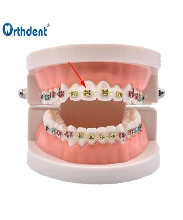 Dental Orthodontic Ligature Ties - 2080Pcs Colored Bands for Braces - Elastomeric Rubber Bands - 2 Bags Included - Buy Online on GoSupps.com