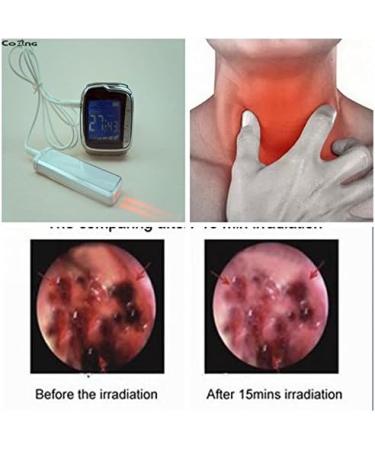 Therapeutic Laser Wrist Watch Blood Pressure and Intranasal Irradiation - Buy Online on GoSupps.com