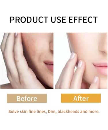 Set Coreano de arroz cuidado de la piel Self-Care Juego de 5 productos para el cuidado de la piel de la cara de arroz  - Buy Online on GoSupps.com