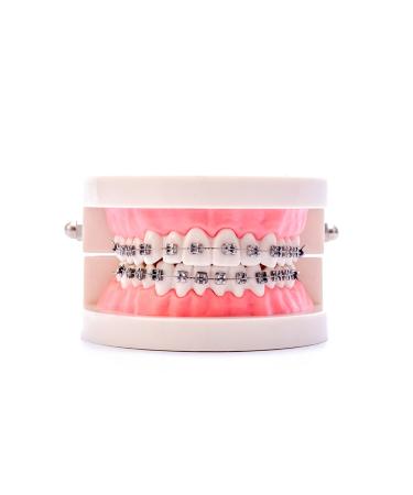 Buy Dental Orthodontic Standard Teeth Model with Metal Brackets & Wires - International Shipping Available - Buy Online on GoSupps.com