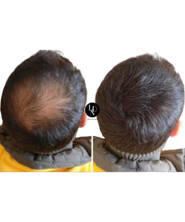  LDN Professional LDN Professional Hair Fibers No. 1. Hair fibers for hair loss and thinning hair instantly thicken hair naturally 22g bottle of hair fibers (medium brown) - Buy Online on GoSupps.com