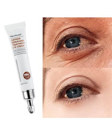 Magic Eye Cream  Instantly Remove Eye Bags Wrinkles Fine Lines Dark Circles  Anti Aging Eye Cream