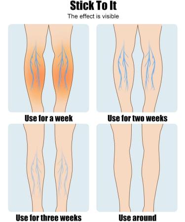 Buy KEDUODUO Heated Leg Massagers - Thigh & Calf Compression & Vibration Therapy (2pcs) - International Shipping Available - Buy Online on GoSupps.com