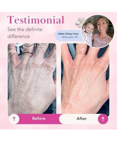 Theraplex Clear Emollient Lotion (8 oz) - No Parabens or Preservatives Noncomedogenic and Hypoallergenic Fragrance Free Dermatologist recommended - National Eczema Association Seal of Acceptance - Buy Online on GoSupps.com