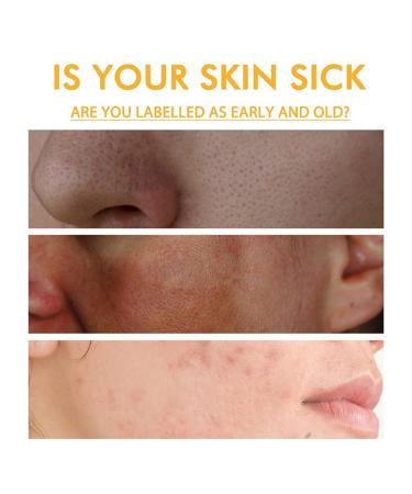 2024 Rejuvenating Honey Peel-Off Mask | Anti-Aging Nourishing & Muscle Tearing Solution - Buy Online on GoSupps.com