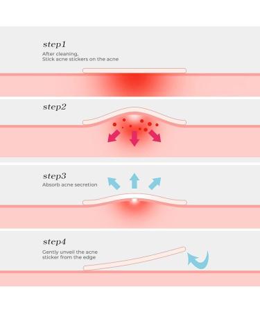 Buy Colorful Hydrocolloid Pimple Patches for Face | Star Acne Stickers in Small Medium Large | Salicylic Blemish Treatment - Buy Online on GoSupps.com
