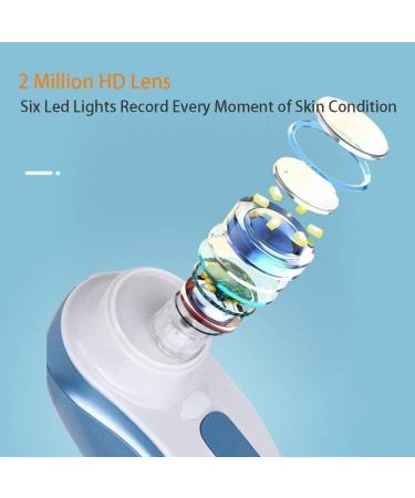 ZQQZEZ Electric Visual Blackhead Absorber 3 Modes Portable Blackheads Suction Device USB Rechargeable Blackhead Suction Tool with 6 LED Lights for Facial Deep Cleansing (Color : Gray)(Blue) - Buy Online on GoSupps.com