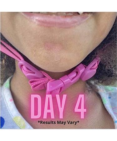 Buy RICHSKIN.co Original SOS Shea Butter for Face & Body | Healing Essential Oil Blend Nourish and Revitalize Your Skin - Buy Online on GoSupps.com