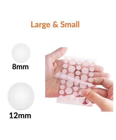 Pimple Patches 180 Count with Tweezers - Hydrocolloid Acne Cover Patch for Quick Healing - Spot Stickers for Face and Skin - Buy Online on GoSupps.com