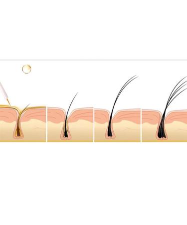 ACSUSS 3ml Eyelash Serum For Longer Fuller Lashes Natural Nourishing Formula Enhances Lash Growth For Women And Girls Daily Care White One Size One Size White - Buy Online on GoSupps.com