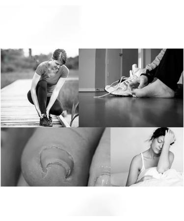 Nail Correction Toe Nail Correction Tool Ingrown Toenail Treatment Tool Painless Inflammation Cure Metal Pedicure Manicure/138 - Buy Online on GoSupps.com