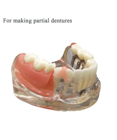 Denture Repair Kit: Gum Material for DIY Smile Improvement & Teeth Fitting - Buy Online on GoSupps.com
