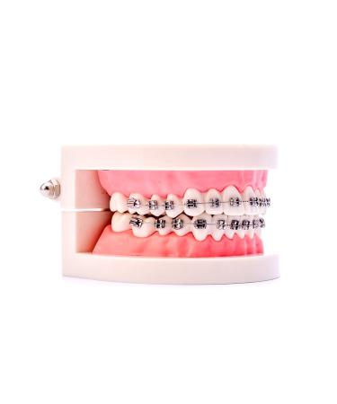 Buy Dental Orthodontic Standard Teeth Model with Metal Brackets & Wires - International Shipping Available - Buy Online on GoSupps.com
