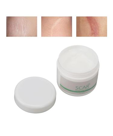 Jopwkuin Scar Removal Cream - Reduce Wrinkles & Soothe Surgery Scars - For Men - Buy Online on GoSupps.com
