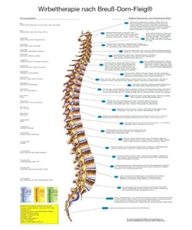 Spinal therapy according to Breuß-Dorn-Fleig (Din A2)