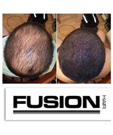 HAIR FUSION Dark Brown: 100% Real Human Hair Fibers for Baldness & Thinning - Root Touch Up, Volumizer - Unisex (1.05 oz) - Buy Online on GoSupps.com