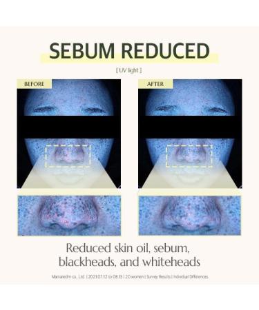 Innerest CHICHO Herb Infused Calming Cream | Daily Moisturizer | Sensitive Skin | Vegan Certified | Houttuynia Cordata Centella Asiatica Hydrating Nourishing - Buy Online on GoSupps.com