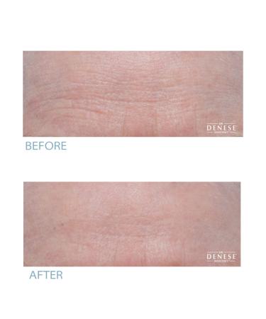 Buy Dr. Denese Hydroshield Pro Strength Serum - Best Hydrating Skincare for Global Shipping - Buy Online on GoSupps.com