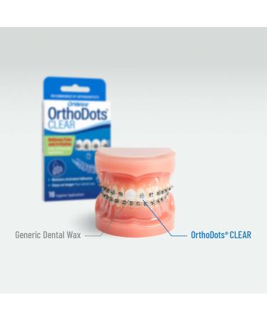 OrthoDots CLEAR (24 Count) - Silicone Dental Wax Alternative for Braces Pain Relief - Long-lasting & Moisture Activated - Pack of 2 - Buy Online on GoSupps.com