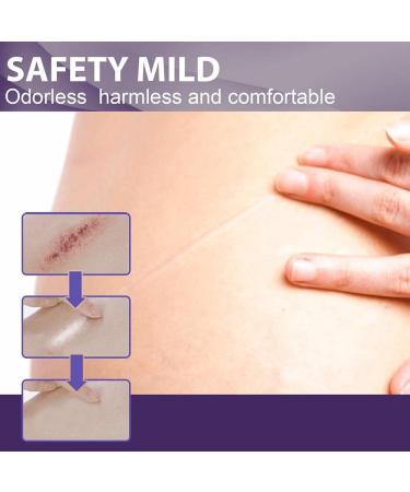 Silicone Gel Scar Removal Patch - Self-Adhesive Tape for Burn Trauma, Acne & Surgery Scars - Skin Repair Therapy - Buy Online on GoSupps.com
