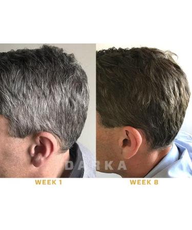DARKA Pro Anti-Greying Hair Serum with Ganoderma Nutrient - Promotes Healthier, Thicker Hair - 2pcs - Buy Online on GoSupps.com