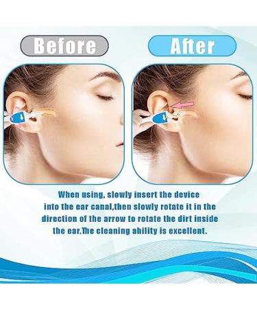 Spiral Ear Wax Remover Tool - Reusable Kit with 16 Soft Replacement Heads for Safe Ear Cleaning | Earwax Removal for Adults and Kids (Light Blue) - Buy Online on GoSupps.com
