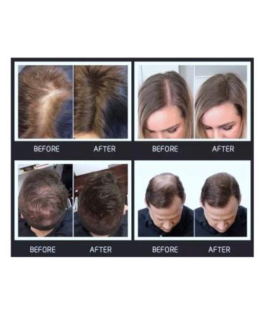 Medium Blonde Hair Building Fiber - Charged Keratin Thinning Hair Filler | Extra Large 27.5g | Long Lasting & Undetectable - Buy Online on GoSupps.com