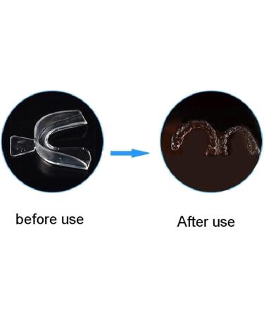 ProEES 2/4-Part EVA Mouthguard | Tooth Protection for Bruxism & Snoring | Night Guard & Whitening Box (4 Colors) - Shop Now! - Buy Online on GoSupps.com
