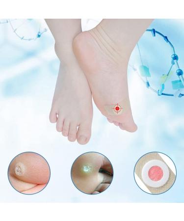 Wart Remover Pads - Treatment for Hands and Feet, Callus Removal, Verruca Relief, Pain Removal - 20 Count Pack - Buy Online on GoSupps.com