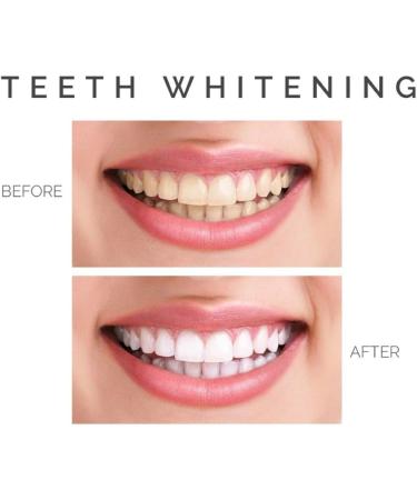 Teeth Whitening Strips - 21 Day Treatment - 42 Dentist-Formulated & Enamel Safe Strips - No Sensitivity - Natural Ingredients - Buy Online on GoSupps.com