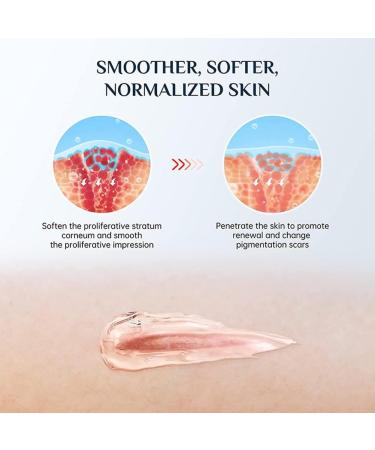 Finxenow ASMOXA Silicone Scar Gel - Effective C-Section & Stretch Mark Scar Remover - 3PCS - Buy Online on GoSupps.com