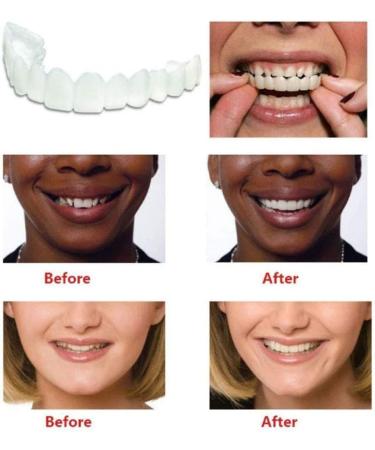 Instant Snap Veneers - Comfortable Flexible Dentures for a Perfect Smile | Top & Bottom Teeth Enhancement - Buy Online on GoSupps.com