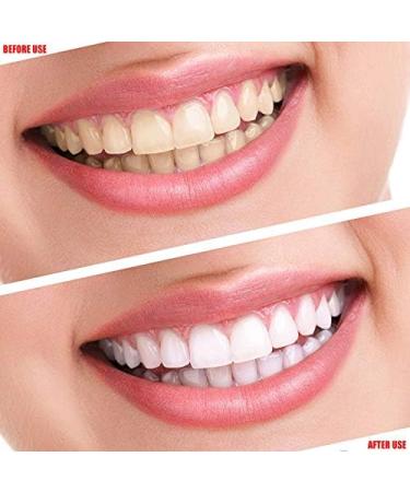 Arinda 14/7Pcs Gel Teeth Whitening Strips White Tooth Kit Oral Hygiene Care Strip for Teeth Veneers 1 Count (Pack of 1) 7pcs - Buy Online on GoSupps.com
