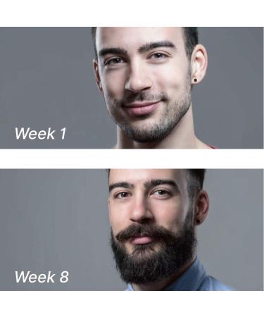 YOOBEAUL Beard Derma Roller for Men - Beard Growth & Care Kit Refill - Buy Online on GoSupps.com