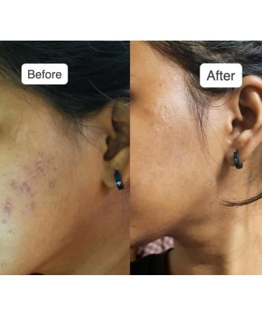 Vilvah Store Milk Drops Brightening Serum - Fades Scars & Evens Skin Tone with Rice Milk & Marine Algae - 0.67 fl oz - Buy Online on GoSupps.com