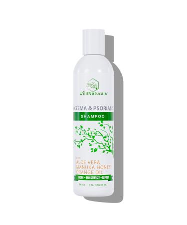 Psoriasis Shampoo for Scalp Care - Eczema Shampoo for Scalp Relief - Hydrating Scalp Psoriasis Shampoo for Itchy Scalp Treatment - Anti Dandruff and Dry Scalp Shampoo - Gentle Itchy Scalp Shampoo 8 Fl Oz (Pack of 1)