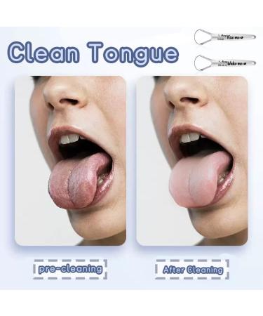 Anniversary & Wedding Gifts for Couples | Stainless Steel Tongue Scraper Cleaner 2-Pack - Perfect for Engaged & Valentine's Day - Buy Online on GoSupps.com