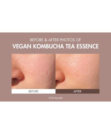 Leegeehaam Dr.Ceuracle Vegan Kombucha Tea Special Set - Korean Hydrating & Nourishing Skincare Gift Set | Essence Gel Cream & Lip Balm - Buy Online on GoSupps.com