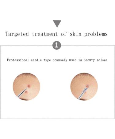Acne Needle Cell Clamp Squeeze Acne Beauty Salon Special Blackhead Acne Needle Acne Clamp Squeeze Acne Closed Mouth Clean A - Buy Online on GoSupps.com