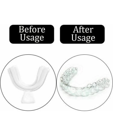 12PCS Silicone Mouth Guard Teeth Night Clenching Grinding Sleep Dental Care - Buy Online on GoSupps.com