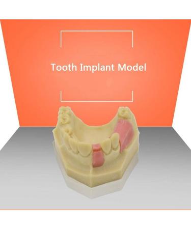 Denture Repair Resin - Medical Training Aid for Dental Education & Planting Training - Buy Online on GoSupps.com