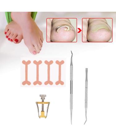 Professional Toenail Correction Tool Set - Steel Nail Corrector Voter & File for Perfect Toenails - Buy Online on GoSupps.com