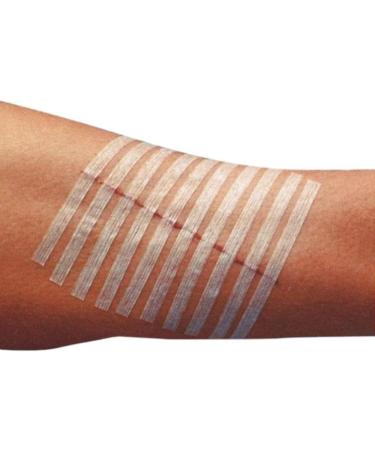 3M Healthcare Steri-Strip 1/4 x 4 Reinforced - Specialty Dressings Woundcare - 10 Strips - Buy Online on GoSupps.com