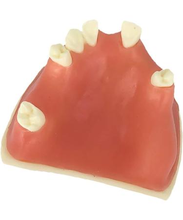 Samnuerly Education Model Toy - Upper Jaw Teeth Model for Sinus Lift & Implant Restoration (40mm) | Premium Dental Educational Tool - Buy Online on GoSupps.com