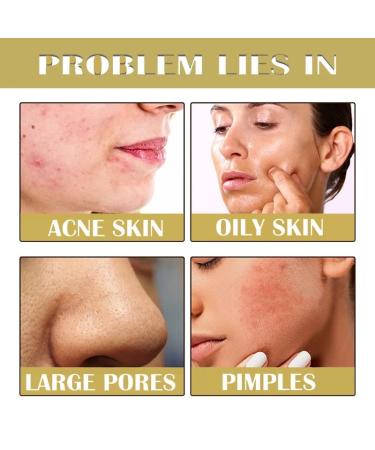 Retinol Snake Venom Peptide Gold Mask Anti-aging Clear and Moisturizing Improving Rough Skin Peeling Mask Tightening Moisturizing Toning and Nourishing The Skin (3PCS) - Buy Online on GoSupps.com