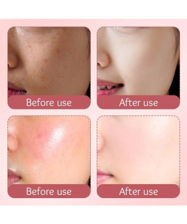 ChongTai 1PC Milk Peach Multi Effect Moisturizing Cream Multi Purpose Soothing Hydrating Nourishing Facial Cream 80g/2.82Oz - Buy Online on GoSupps.com