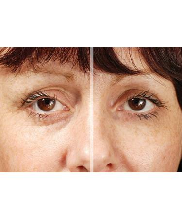 Rox Flawless Eyes by RX | Premium Eye Care for Radiant Skin | Shop Internationally Now - Buy Online on GoSupps.com
