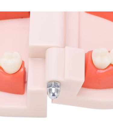 Teeth Model - Anti-Yellow Denture Model for Hospitals & Kindergartens | Shop Internationally - Buy Online on GoSupps.com